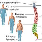 Safehands Spinal Cord Injuries Care