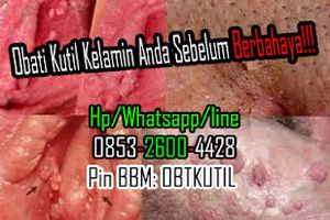 Tuntaskan Kutil Kelamin Pakai Obat Kutil Kelamin Herbal Alami