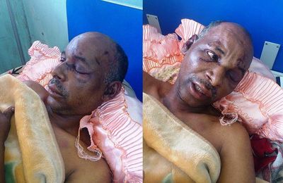 Visage tuméfié de l’Officier Oumar Aboubakar Abdeldjallil, victime de la barbarie et du terrorisme d’Etat au Tchad