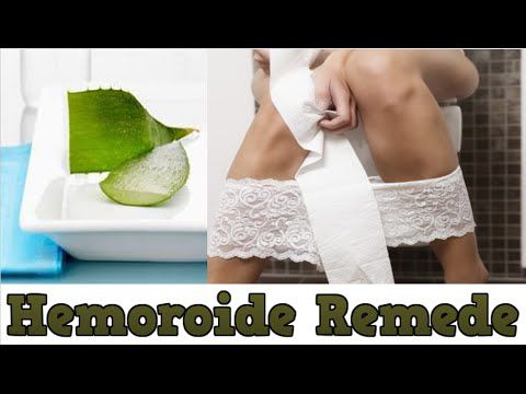 Remede naturel hemoroide interne