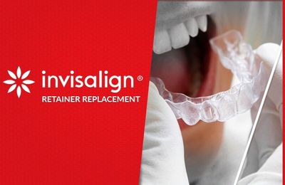 Invisalign Retainer Replacement - The Best Way after Losing Removable Retainers