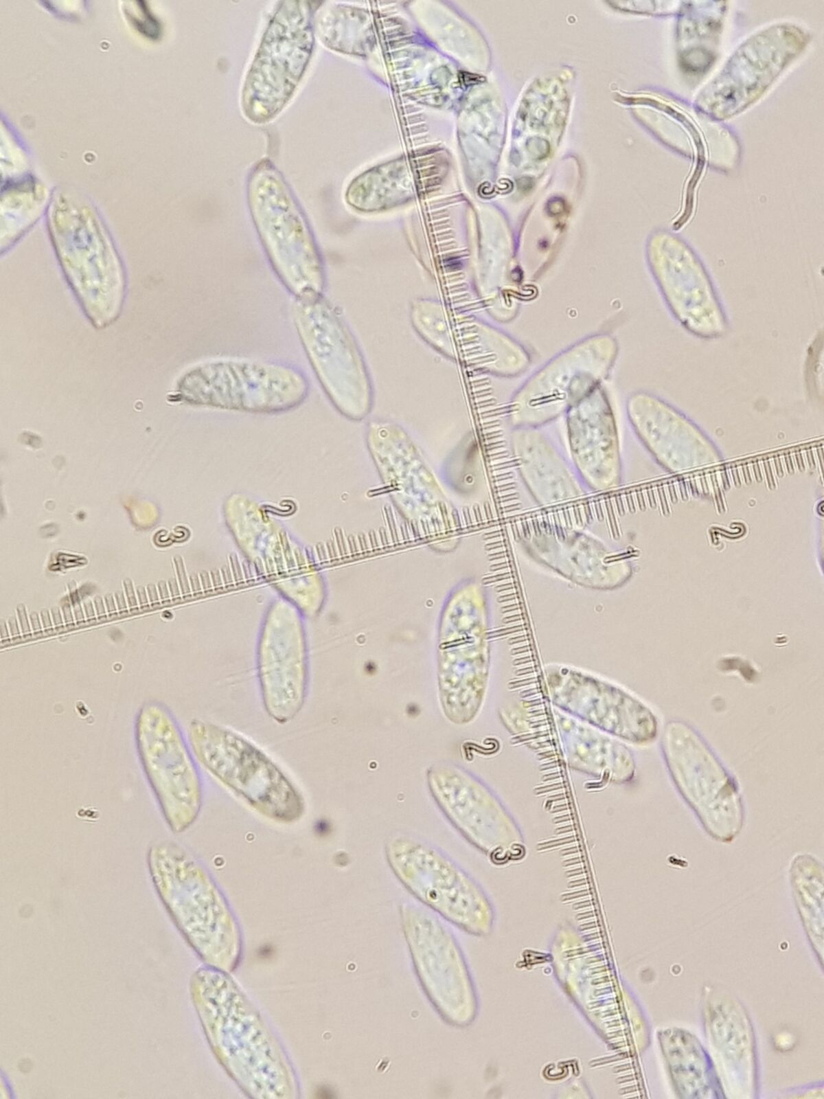 Spores au microscope X 1000- du Polypore moucheté (Polyporus forquignonii)  - Photo Gilles Weiskircher (Anab)
