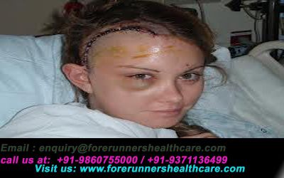 Why get Brain Cancer Surgery in India?