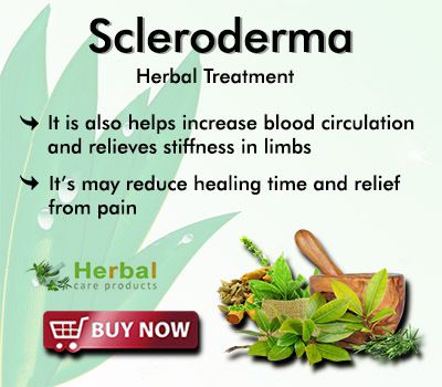 Natural Remedies for Scleroderma with Combination of Herbal Ingredients