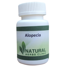 Natural Herbal Remedies For Alopecia