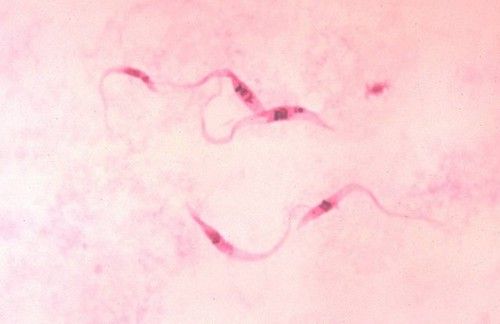 Le trypanosome 