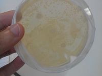 miel de montagne(miel périmé) : il y a la présence de bactérie mais le papier filtre trempé dans le miel à réagit à 0.2 cm pour chacune des trois petites disquettes
