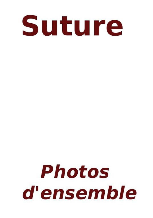 Album - 38-Suture