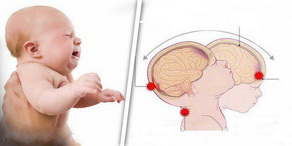 Ne secouez jamais votre bébé, il peut être mortel