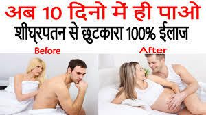 Best Doctor for Treatment of Premature Ejaculation in New Delhi