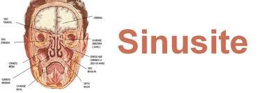 Album - Sinus-et-sinusite