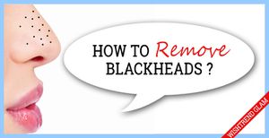 Winning Tactics For Blackheads