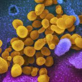 Opinion: Study shows 'long COVID' likely to cause mass misery if treatments can't be developed