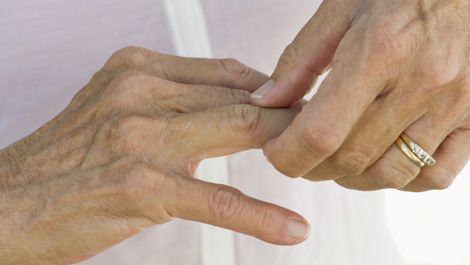 Fibromialgia y artritis ¿están relacionadas?