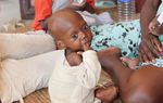 La malnutrition, un danger accru pour les enfants de Centrafrique