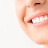 Importance of Replacing Missing Teeth