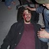 19 mars à Toulouse : le cas d'un étudiant gravement blessé par la police