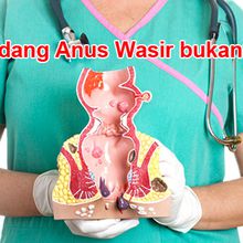 obat ambeien Selain obat dokter | obat ambeien oral