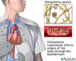 APA BAHAN OBAT PENYAKIT HISTOPLASMOSIS TERBUKTI MANJUR DIAPOTIK UMUM