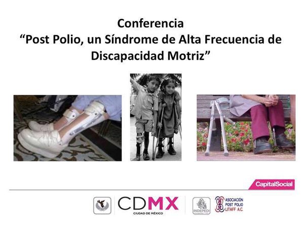 Conferencia Post Polio Síndrome de Alta frecuencia de Discapacidad Motriz.